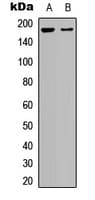 Polyclonal Rabbit anti-Human ADGRB1 / BAI1 Antibody (Internal, IF, WB)