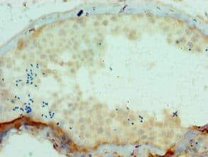 SSX2 Antibody (aa1-188)