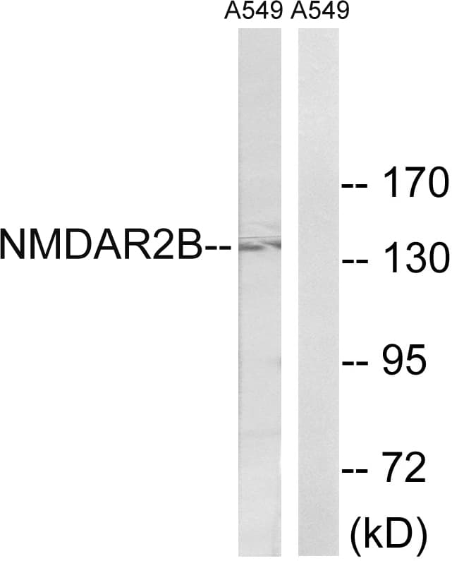 GRIN2B / NMDAR2B / NR2B Antibody (aa1302-1351)