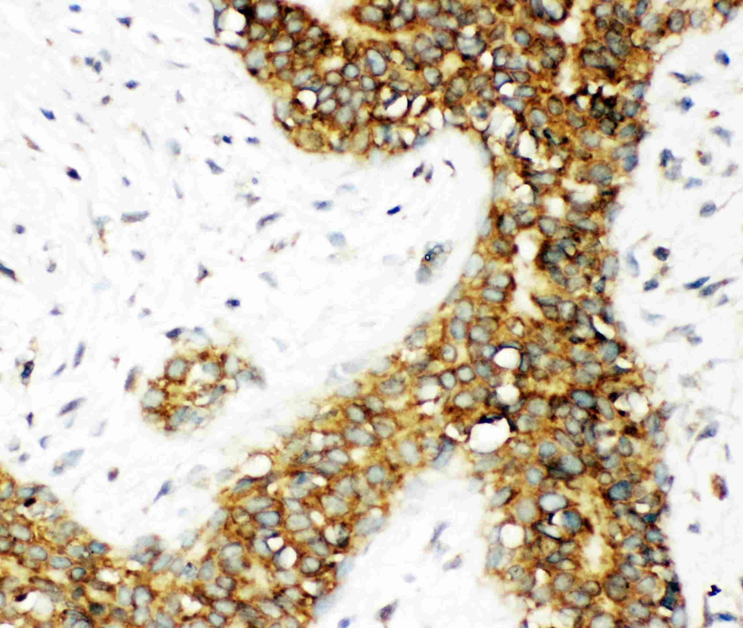 CALB1 / Calbindin Antibody (aa2-175)