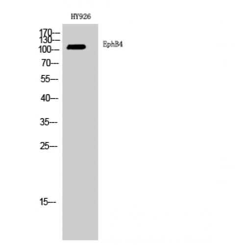 EPHB4 / EPH Receptor B4 Antibody (540-620 aa, Internal)