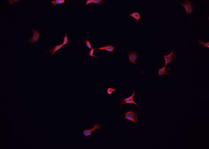 LPAR1 / LPA1 / EDG2 Antibody
