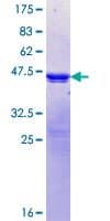 Human PPP1R3A / GM Protein (Recombinant GST, N-terminus)