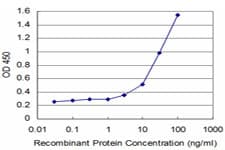 Monoclonal Mouse anti-Human SYN1 / Synapsin 1 Antibody (clone 1D10, WB)