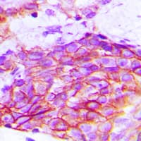 Polyclonal Rabbit anti-Human KDR / VEGFR2 / FLK1 Antibody (Internal, IHC, IF, WB)