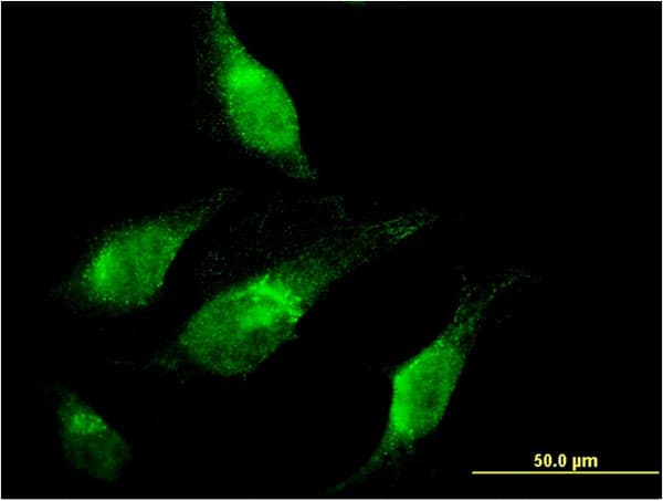 IHC-plus™ CHD1 Antibody (clone 1G2)