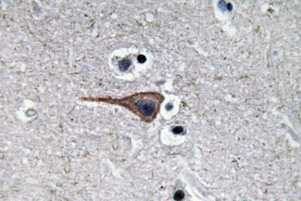 EGF Antibody (aa660-709)