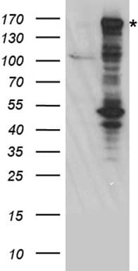 BAZ1B / WSTF Antibody