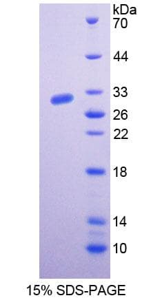 Rat BCHE / Cholinesterase Protein (Recombinant His-T7)