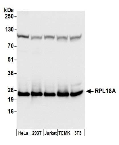 Polyclonal Rabbit anti-Human RPL18A Antibody (aa126-176, WB)