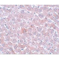 RSRC1 Antibody