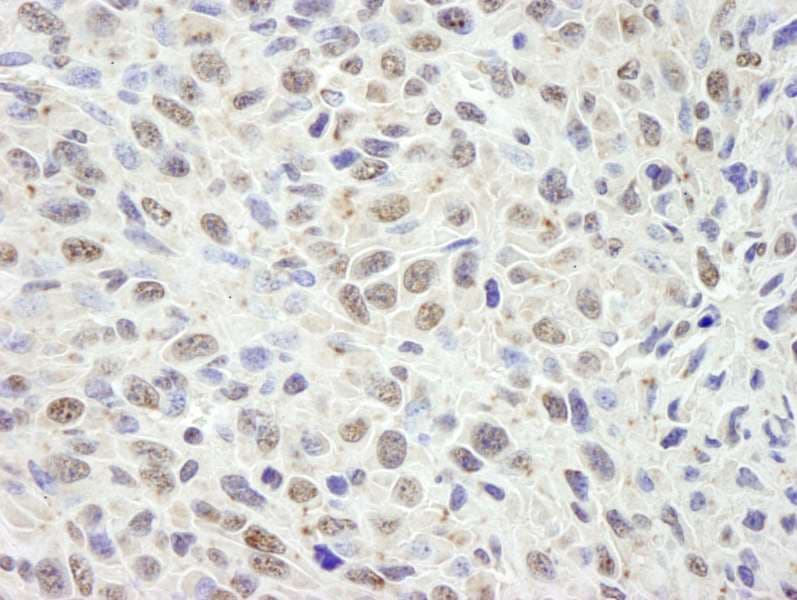 DIS / CCAR1 Antibody (aa1-50)
