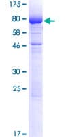 Human GPKOW Protein (Recombinant GST)