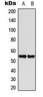 KRT8 / CK8 / Cytokeratin 8 Antibody (C-Terminus)