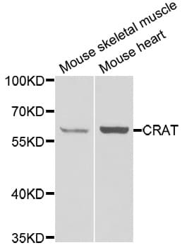 CRAT Antibody