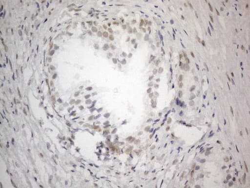 Monoclonal Mouse anti-Human CWC27 Antibody (clone OTI4C8, aa145-472, IHC, WB)