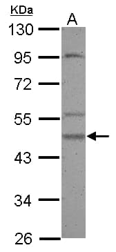 Polyclonal Rabbit anti-Human CSNK1G2 / CKI-Gamma 2 Antibody (WB)