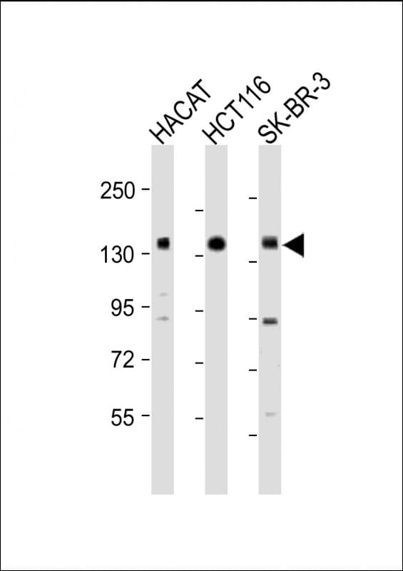 MST1R / RON Antibody (Internal)