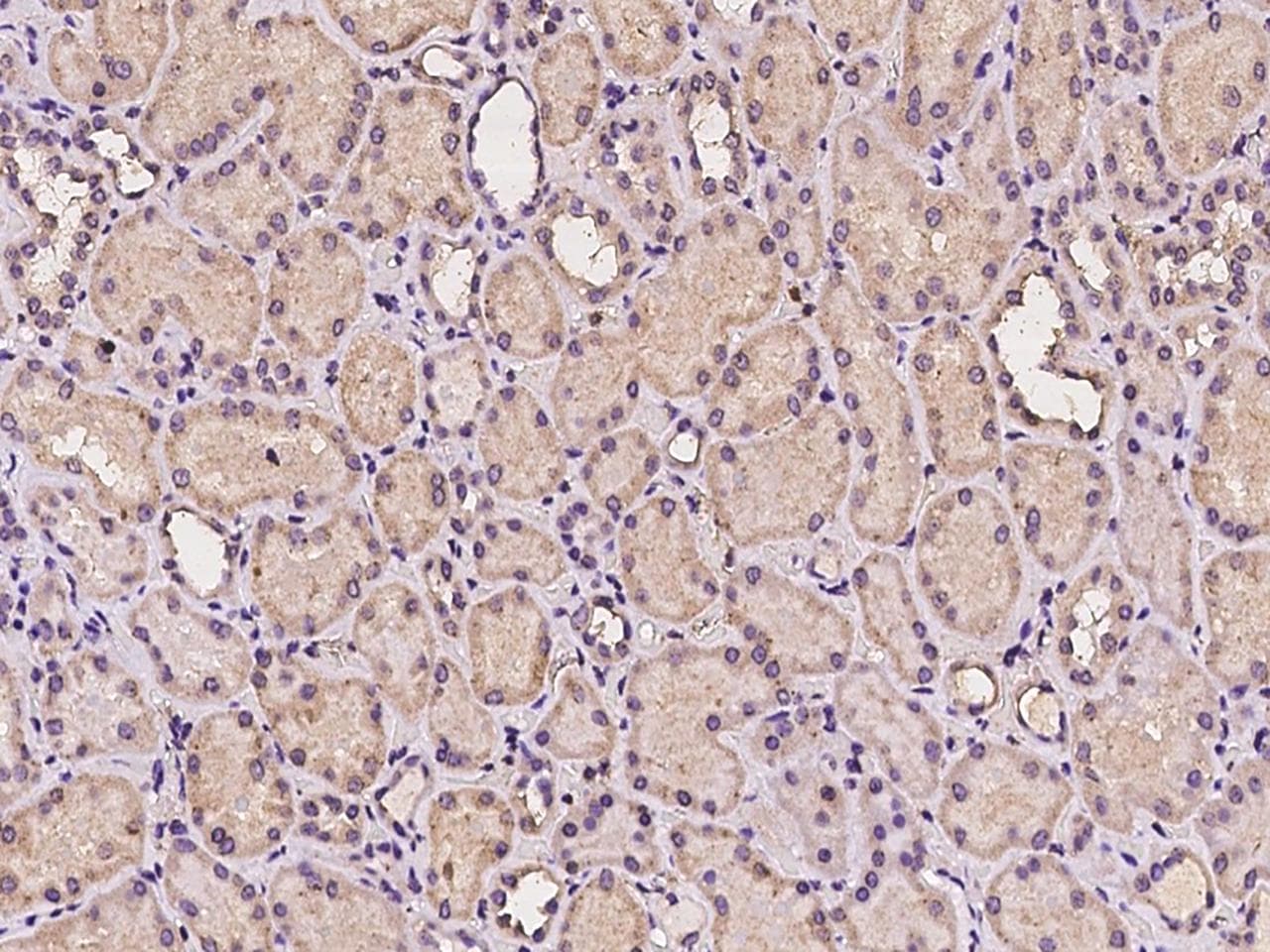 TMEM106C Antibody