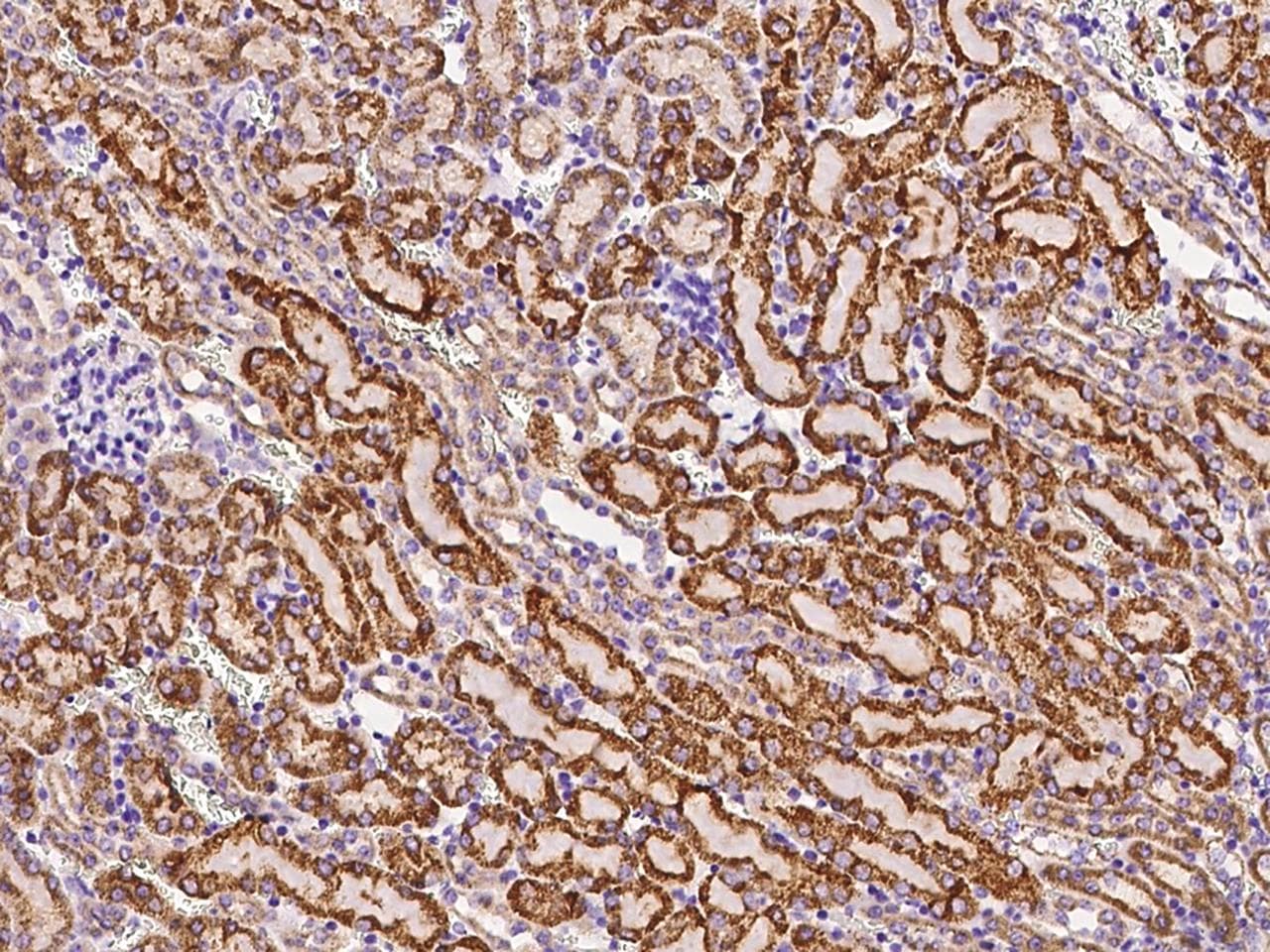 Polyclonal Rabbit anti-Mouse GLIS1 Antibody (IHC)