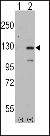 IHC-plus™ DAAM1 Antibody (aa45-74)