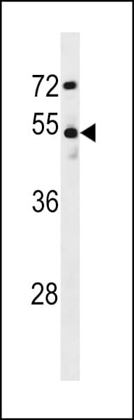 DCLK / DCLK1 Antibody (aa685-712)