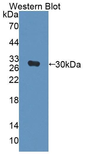 CENPJ / LAP Antibody (aa1-207, PE)
