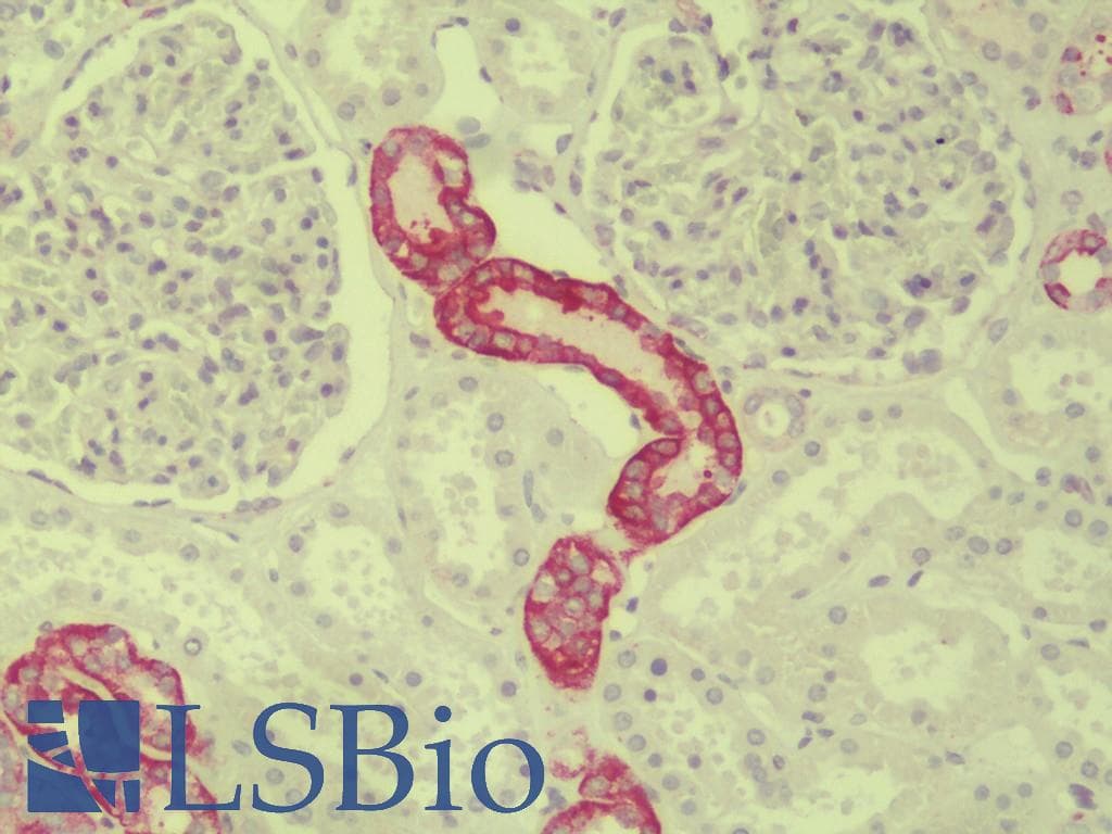 IHC-plus™ Polyclonal Rabbit anti-Human Paralemmin 3 / PALM3 Antibody (IHC, IF, WB)