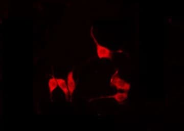 BABP / AKR1C2 Antibody