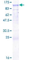 Human CD19 Protein (Recombinant GST)
