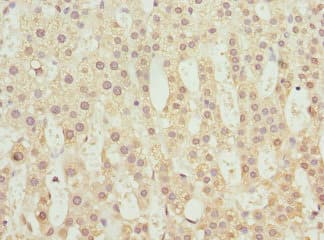 Polyclonal Rabbit anti-Human TCBE / KCS / HRD Antibody (IHC, WB)