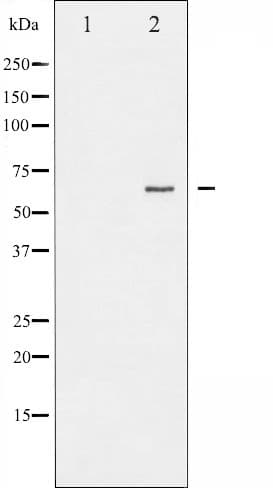 RELA / NFKB p65 Antibody