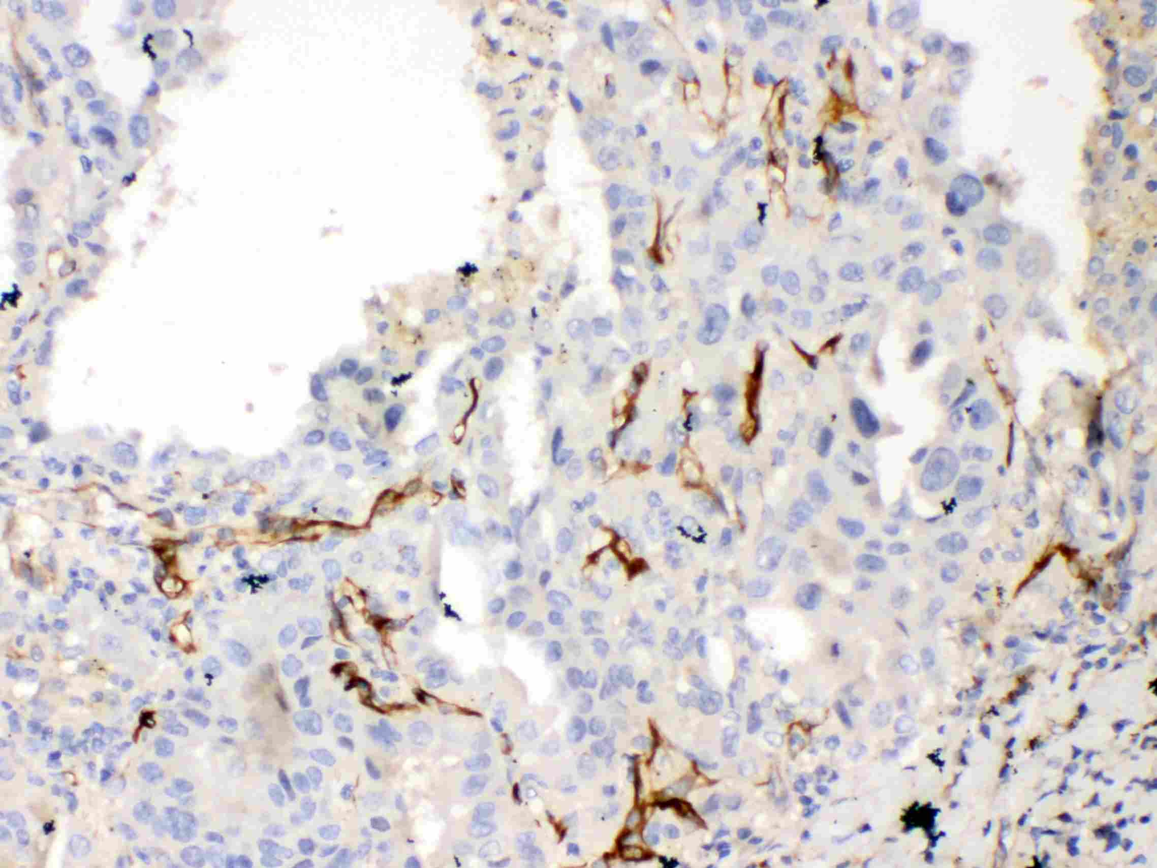 BCL2L1 / BCL-XL Antibody