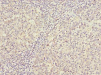 PSMD8 / RPN12 Antibody
