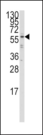IRF5 Antibody (aa81-108)