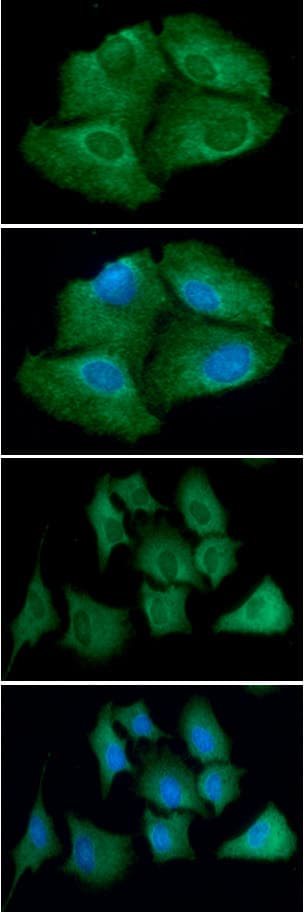 TRXR1 / TXNRD1 Antibody (clone AT30F1)