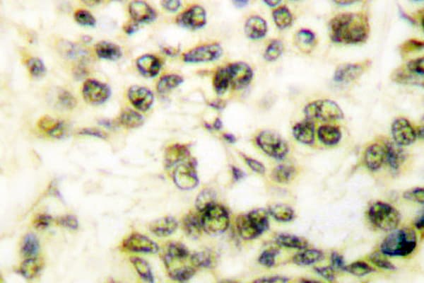 PRKDC / DNA-PKcs Antibody (Arg4090)