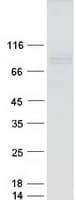 Human ADAMTS4 Protein (Recombinant Myc-DDK (Flag))
