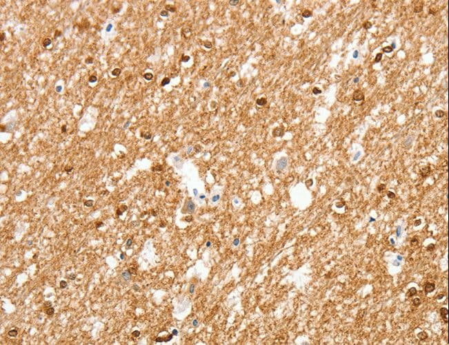 AMZ1 Antibody