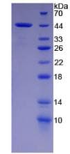 Rat CCK / Cholecystokinin Protein (Recombinant His-GST)