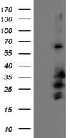 REEP2 Antibody (clone OTI2C7)