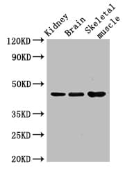 CASP4 / Caspase 4 Antibody