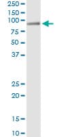 HAL / Histidine Ammonium Lyase Antibody (clone 4F2)