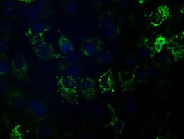 HIBCH Antibody (clone OTI1C7)