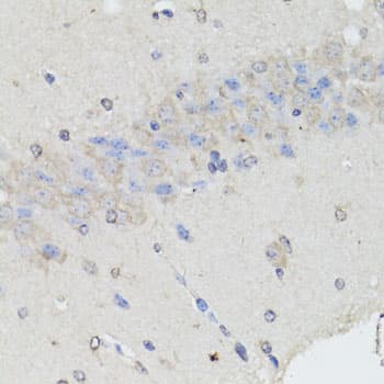 CHGA / Chromogranin A Antibody