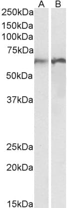 IHC-plus™ CALR / Calreticulin Antibody (aa291-304)