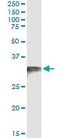Monoclonal Mouse anti-Human HCCS Antibody (clone 3C7)