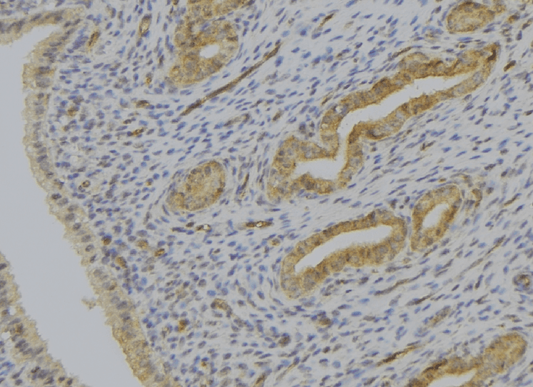 Polyclonal Rabbit anti-Human SERPINE2 / Nexin Antibody (IHC, WB)