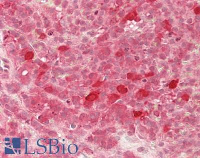 IHC-plus™ GADD45A / GADD45 Antibody
