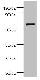 COL10A1 / Collagen X Antibody (aa521-680)